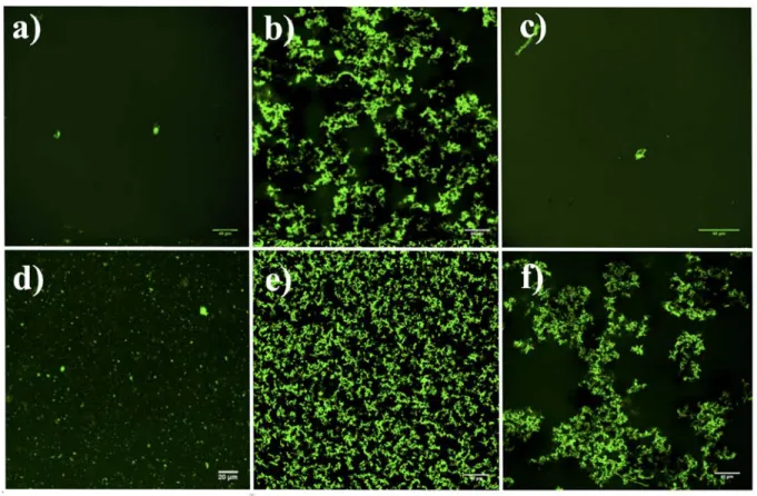 Figure 5. Fluorescence microscopy images (green channel) captured after incubation at 37 °C  for: a) 31.2 µM RCA 120 -Fluorescein, b) 31.2 µM RCA 120 -Fluorescein/200 µM ELP(Gal), c) 31.2  µM RCA 120 -Fluorescein/200 µM ELP(Glc), d) 31.2 µM RCA 120 -Fluore