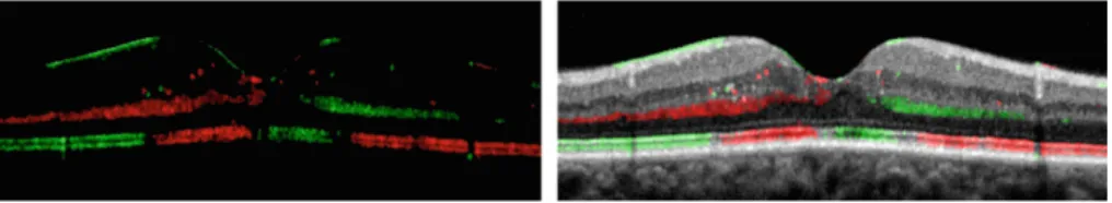 Fig. 8. Final images (I RG and I RGB ) obtained after RMF based regularization, less noisy than in Fig