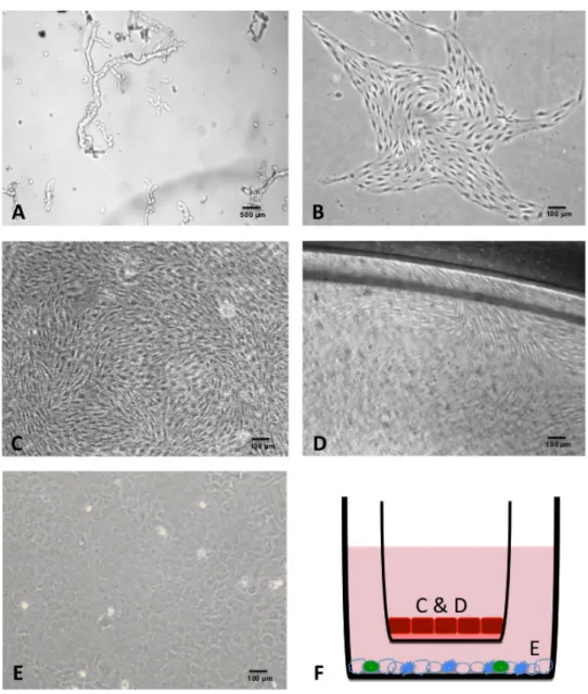 Figure 2. Phase contrast photomicrographs of RBEC, astrocytes and the co-culture system