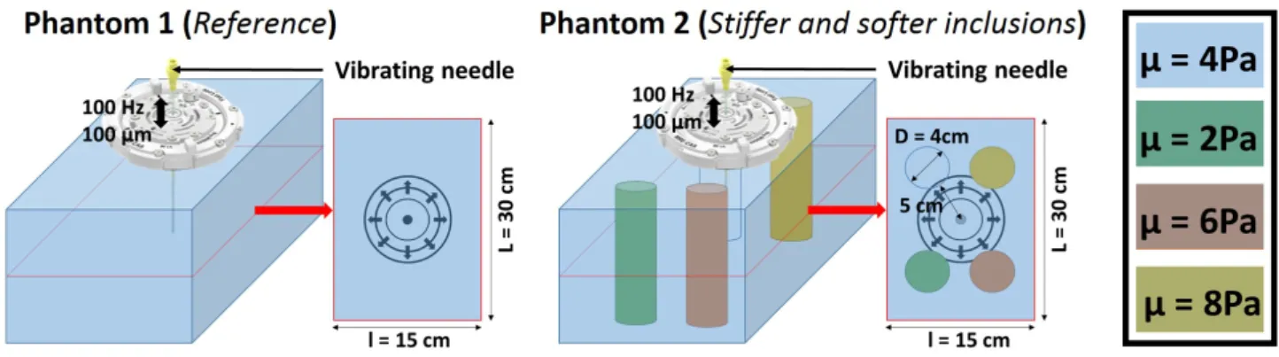 Figure 1: Left: Reference hydrogel phantom. Right: Hydrogel phantom with stiff and soft inclusions