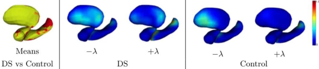 Fig. 4. Statistical analysis of momentum vectors for Down’s syndrome (DS) and healthy control population