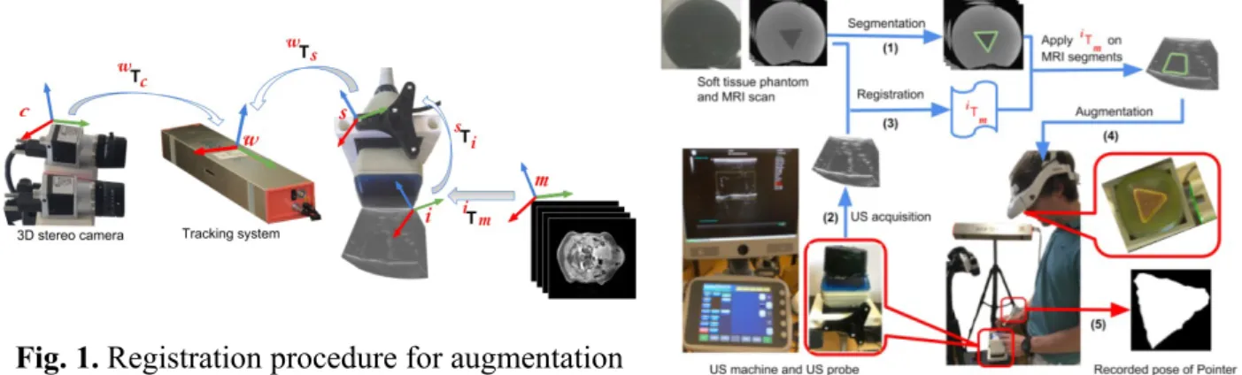 Fig. 1. Registration procedure for augmentation of stereo camera with MRI image