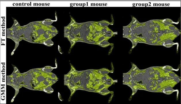 Figure 6 shows the repartition of adipose tissues in obese and control mice using the GMM method and the FT method