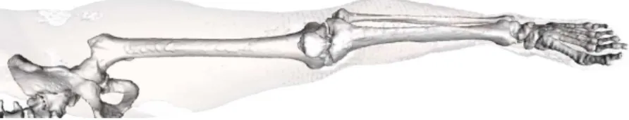 Figure 8: Surface meshing of the 3D model obtained for the bones of a segmented CT of an entire leg.