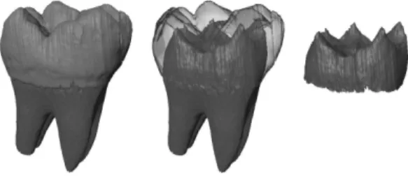 Figure 1: L’interface émail-dentine (à droite) est la surface de jonction entre la dentine (en bleu) et l’émail (en violet).