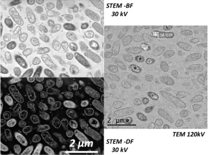 Fig. 11: Comparison of STEM-in-SEM at 30kV and TEM at 120kV 