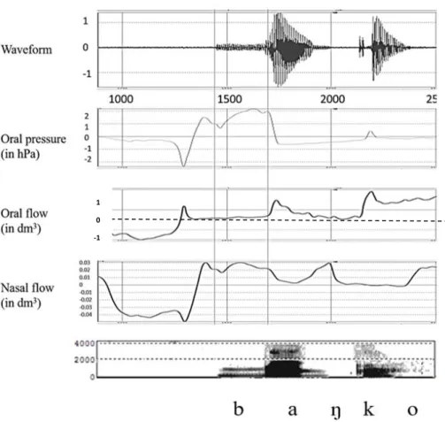Figure 2. Waveform, intraoral pressure, oral flow, nasal flow and spectrogram (0-4KHz) for  Spanish banco (‘bank’) by an apraxic speaker