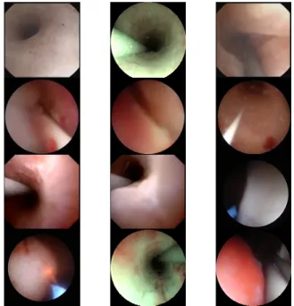 Fig. 1: Sample of images in the dataset collected showing the variability of the hue as well as the shape and location of the tissue which sometimes merges with the tool and the guide-wire.
