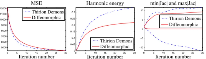 Fig. 4. Comparison of Thirion’s demons algorithm with the diffeomorphic demons algorithm on the BrainWeb images shown in Fig