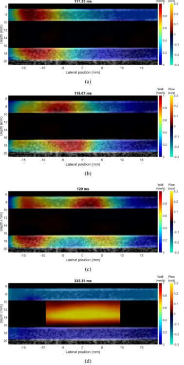 Fig. 2. Estimated velocity profiles on average (with all phantoms from 2 to 5 cycles) for the high pressure (blue) and the low pressure (red) at 333.33 ms.