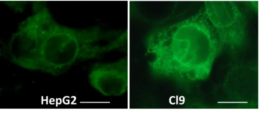Figure  2.  Localisation  cellulaire  de  SigR1  dans  des  cellules  hépatocytaires  surexprimant  ou  non  SigR1