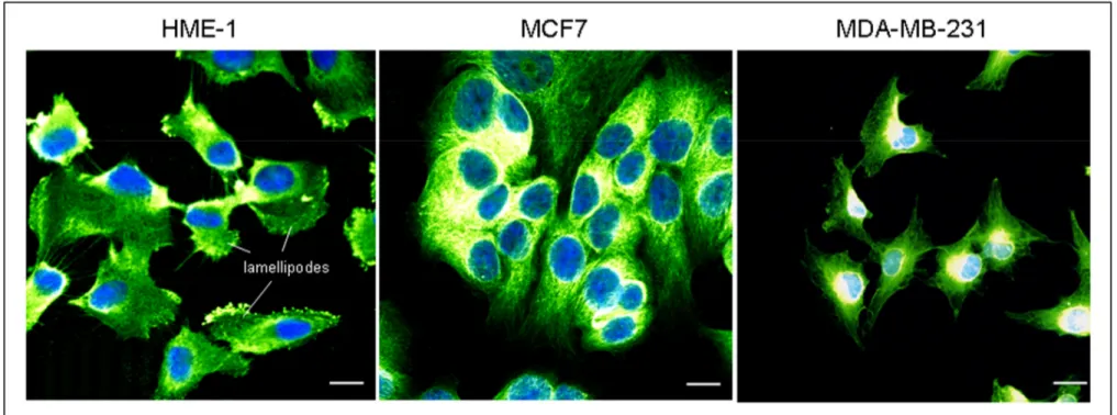 Figure 15 : Cellules HME-1, MCF7 et MDA-MB-231 après marquage avec un anticorps anti-β-tubuline (vert) et avec un marqueur  nucléaire (DAPI, bleu)