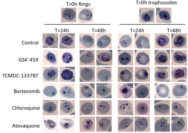 Figure  4.  Effect  of  proteasome  inhibitors  identified  on  the  intraerythrocytic  parasite  343 