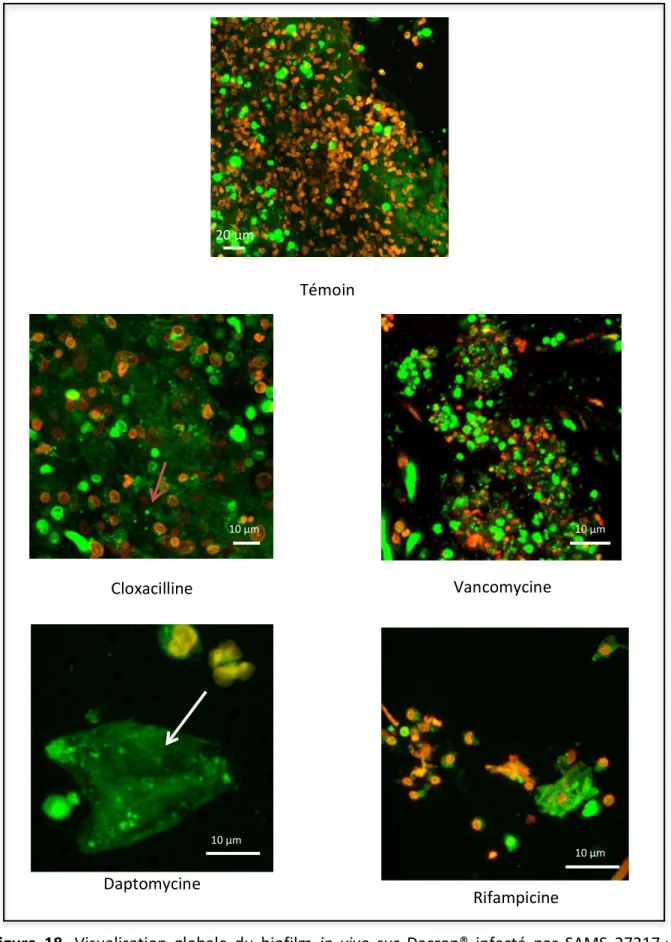 Figure  18.  Visualisation  globale  du  biofilm  in  vivo  sur  Dacron®  infecté  par  SAMS  27217 :  monothérapies  Visualisation pour double marquage Syto9® (cellules vivantes en vert) et Iodure de Propidium (cellules mortes  en rouge) selon le protocol