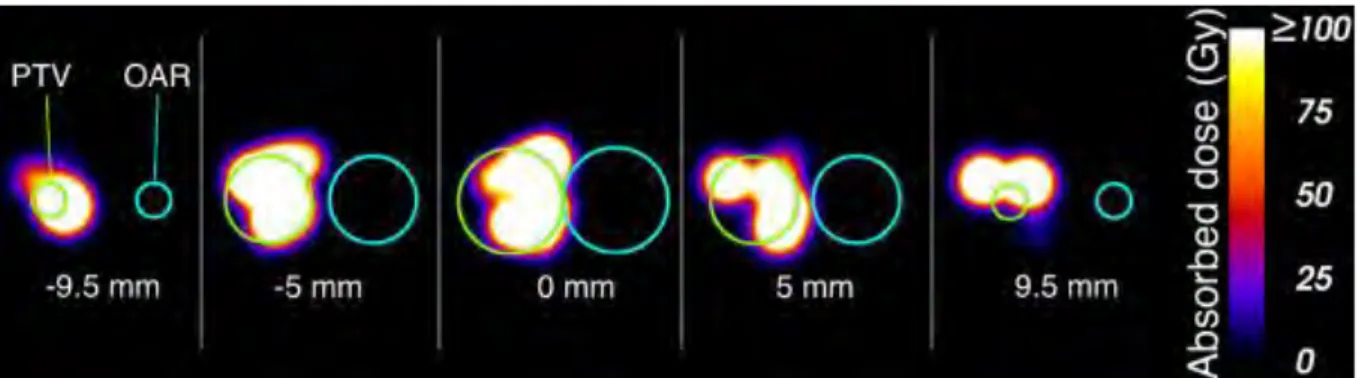 Figure 3.8: Slices through the dose grid. The edges of the PTV and OAR are shown in green and cyan, respectively