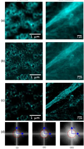 Fig. 3. Experimental images of podosomes (left column) and dense actin filaments (right column)