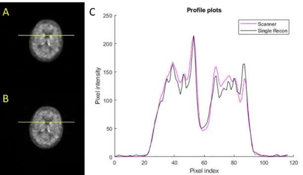 Figure 9: Comparison between the scanner and the  implemented single time-point  reconstruction