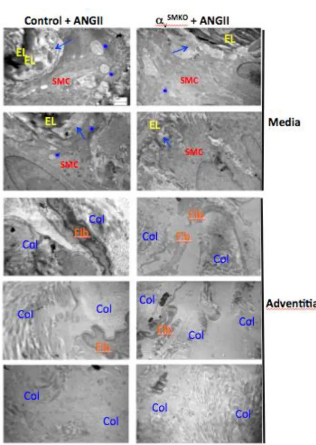 Figure 19. Electronic microscopy analysis of mice carotids. (A) Four representative images from the media region of carotids  are  presented  in  the  upper  panel  and  four  representative  images  from  the  adventitia  region  in  the  lower  panels