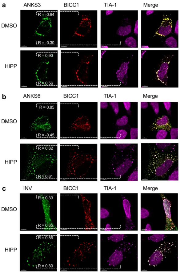 Figure 8.  BICC1-mediated recruitment of NPH proteins into stress granules. (a) Co-expression of BICC1  recruited ANKS3 into granules that co-localized with TIA-1 in response to 1 mM hippuristanol