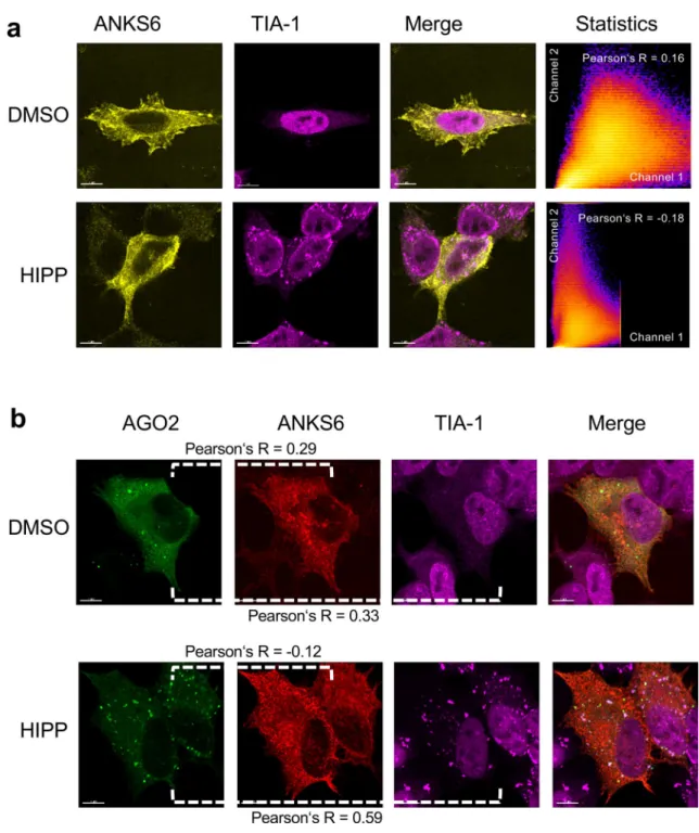 Figure 5.  Localization of ANKS6 in response to hippuristanol. (a) HeLa cells were transfected with RFP-tagged  ANKS6, and either exposed to DMSO or 1 mM hippuristanol for 1 h