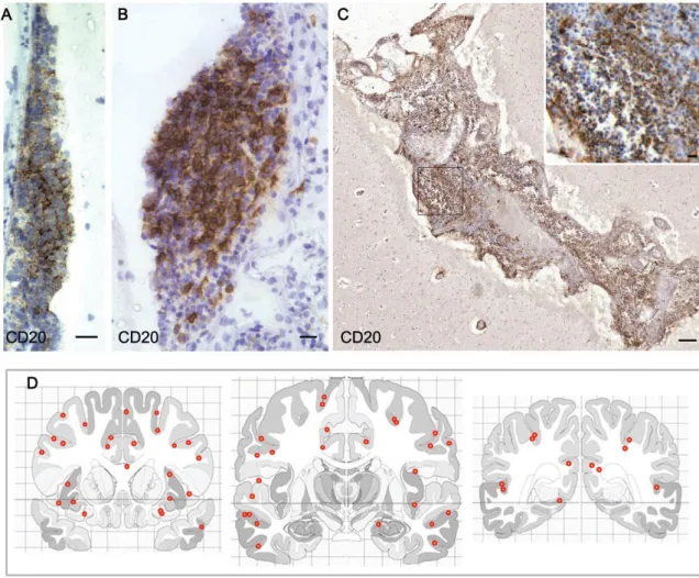 Figure 2.4: Follicle-like structures are variable in size and anatomical location 