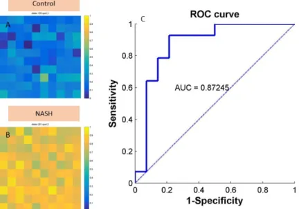 Fig. 4. A) and B) The diagnostic plot for a true negative and true positive sample where the pixels’ intensity represents the probability of  being diagnosed as normal or NASH