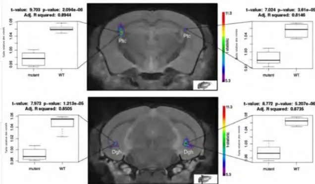 Figure 1.8 – Images de tranches de cerveaux de souris obtenues par IRM. Les tâches colorées représentent les régions significativement différentes entre les souris mutantes et les souris saines
