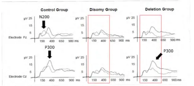 Figure 1.11 – Tracé EEG lors d’une tâche de Go/NoGO. Nous retrouvons les 2 principales compo- compo-santes dans le groupe contrôle (N200 et P300)