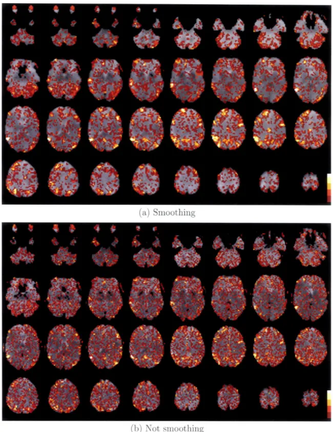 Figure  4-9:  Feature  overlap  maps  corresponding  to  smoothed  data  (a)  and  not smoothed  data  (b)  for  the  best  performing  subject  for  the  memory  task.