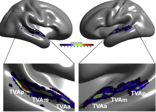 Fig. 2. The human Temporal Voice Areas (TVAs). The TVAs show greater fMRI response to vocal vs