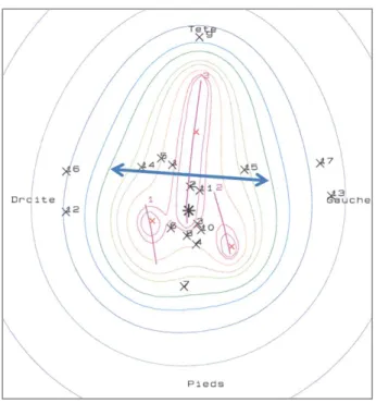 Figure 18 : Choix d’une isodose d’enveloppe pour la prescription, en fonction de ses dimensions