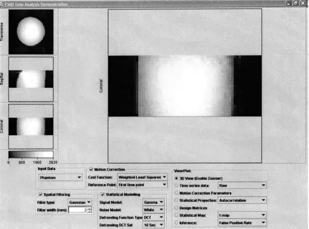Figure  5-1:  Screenshot  of Web-based  Java  Client  for  fMRI  Analysis  of Phantom  data (3D  View)