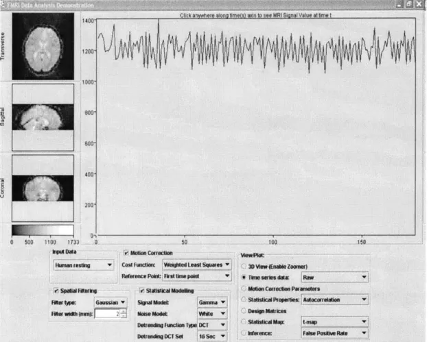Figure  5-2:  Screenshot  of Web-based  Java  Client  for  fMRI  Analysis  of human  brain data  (4D  View)