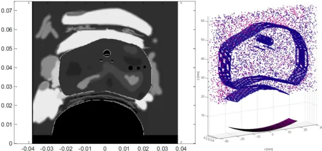 Figure  2:  Left,  an  echogeneicity  map  derived  from  a  segmentation  of  a  B-mode  image  acquired  on  a  prostate  with  the  current  ultrasound  probe  of  the  Ablatherm®