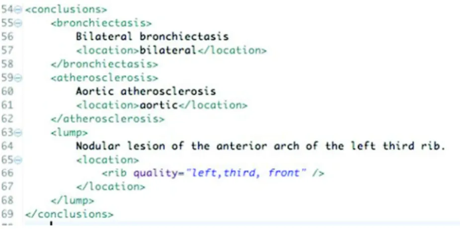 Fig. 3. Conclusion section of the medical report, expressed in CDL. 
