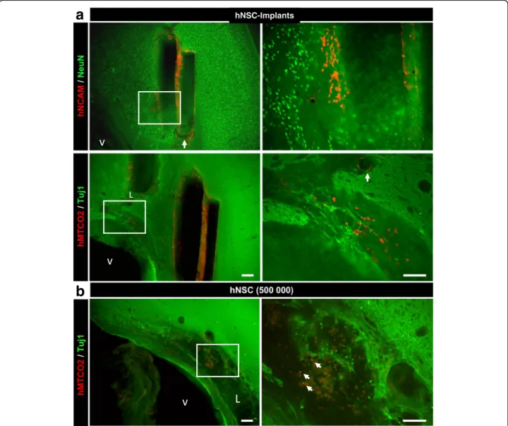 Fig. 4 a hNSC location and survival around neuro-implants 3 months after graft. hNSCs were identified by two specific human markers (red), hMTCO2 or hNCAM, in combination with a marker (green) of immature (Tuj-1) or mature (NeuN) neurons