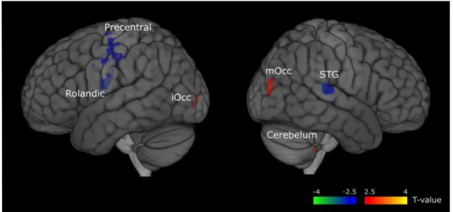 Figure 3. Regions whose source signal activity differed between words and 