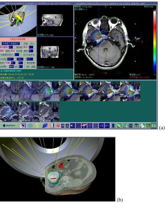 Figure  6. Illustration of treatment planning and simulation for Rotational Gamma System  (LIST, Southeast Univ., China)