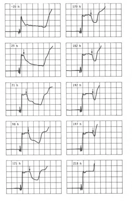 Figure  4.  TDR  waveforms  f o r   t h e   sand  experiment  s c a l e :   v e r t i c a l   200  mpldiv;  h o r i z o n t a l   2  n s / d i v   kV  and  5  ma