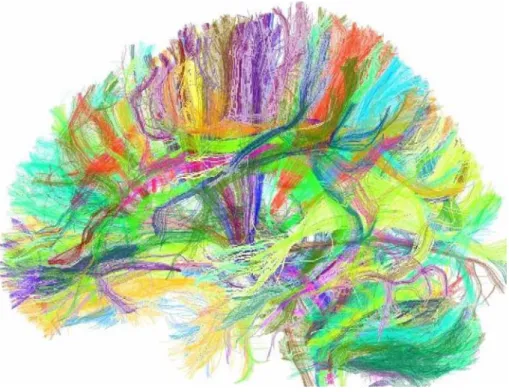 Figure 4. Imagerie de faisceaux nerveux du cerveau par IRM de tenseur de diffusion  (courtoisie Poupon C, Mangin JF, Le Bihan D et al