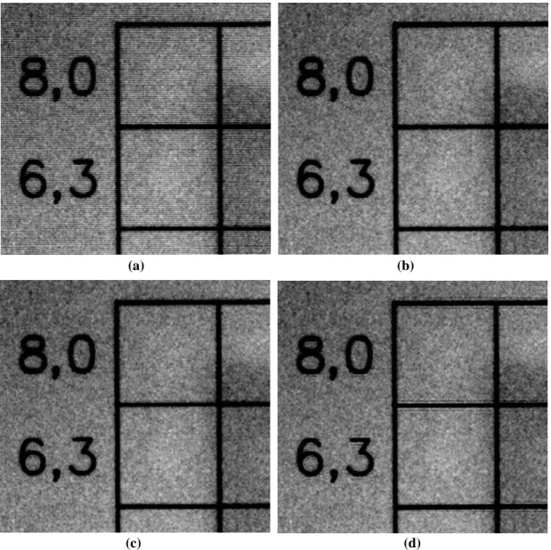 Fig.  5.  (a)  A  zoomed  part  of  the  original  image  with  gridline  artifacts.  The  gridline  artifacts  were  removed using (b) our proposed method; (c) the Gaussian band-stop filter method proposed by Lin et  al