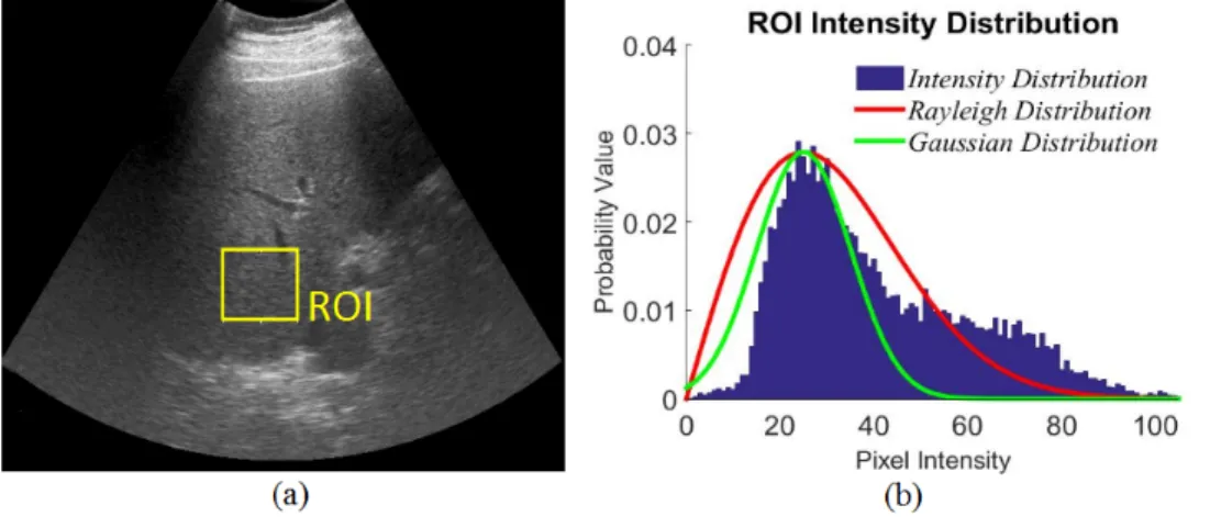 Fig. 1. The histogram of an US abdominal image, (a): original image, (b): histogram of the ROI.