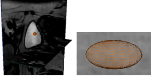 Fig. 1. Initialization of the algorithm: ellipsoidal mesh built from an initial point.