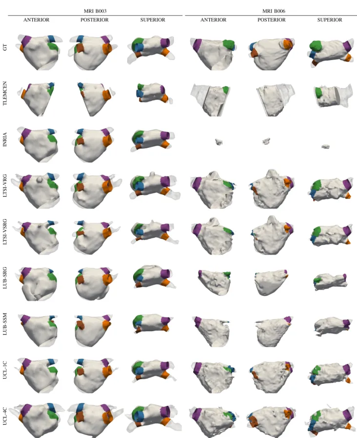 Fig. 7: Results for each algorithm on the MRI datasets. The original meshes are displayed with transparency