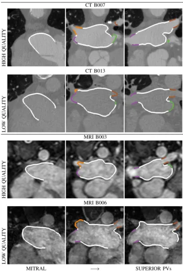 Fig. 1: Examples of datasets provided for the benchmark. A high and a low quality dataset is displayed for each modality