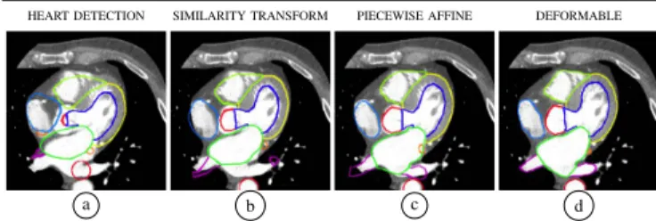 Fig. 2: Automatic segmentation pipeline on a CT image for ground truth generation. Different colours represent different parts of the deformable model