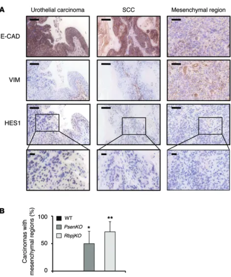 Figure 3. NOTCH inactivation induces the appearance  of mesenchymal regions in SCCs. (A)  Representa-tive examples of IHC stainings against the indicated  proteins on the indicated tumor subtypes and regions