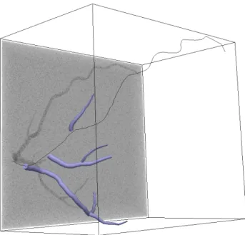 Figure 2: Step of the phantom construction: centerlines, vessel mesh and a MIP of the ﬁnal volume