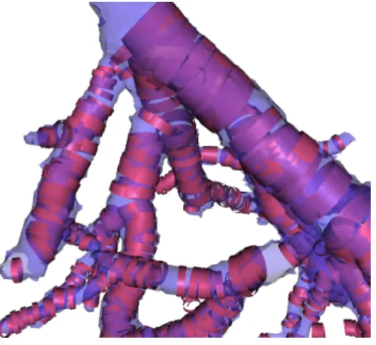 Figure 7: Visualization of the extracted vascular structures superimposed on the detected cylin- cylin-ders seen by transparency.