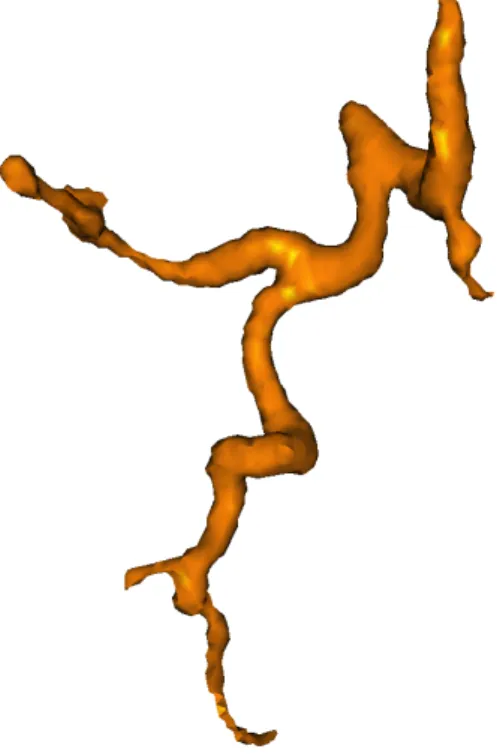 Figure 10: Visualization of the hepatic arterial tree.